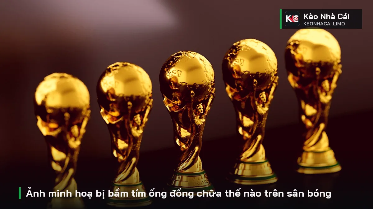 Ảnh minh hoạ bị bầm tím ống đồng chữa thế nào trên sân bóng